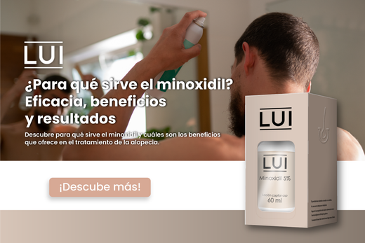 para-que-sirve-el-minoxidil